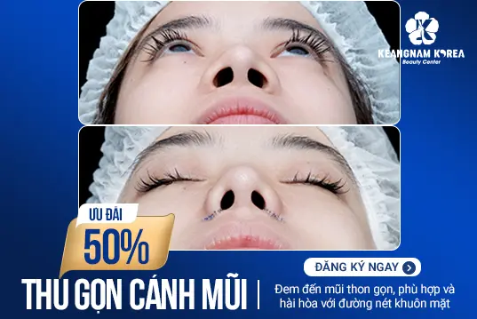 Thu gọn cánh mũi