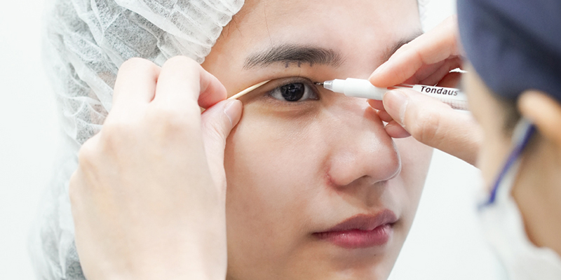Cosmetic Eye Surgery Cost in Vietnam 2026 1 Cosmetic Eye Surgery Cost in Vietnam 2026