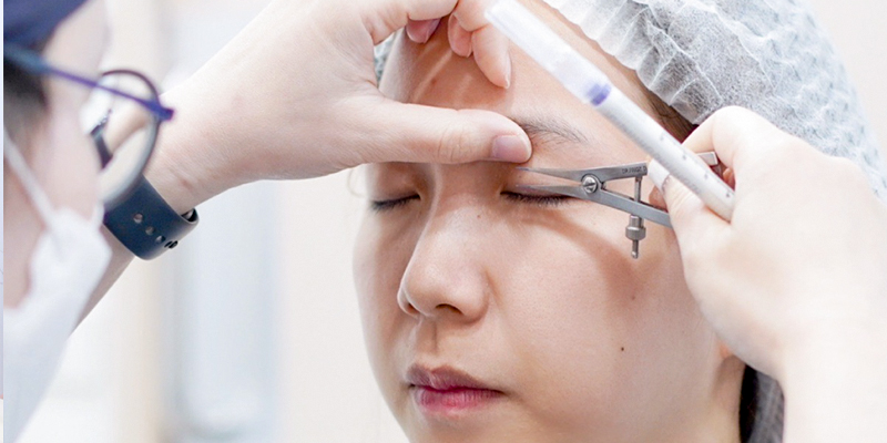 Eye Lift VS Cold Plasma Blepharoplasty: Surgical Techniques, Recovery, and Costs 3 Eye Lift VS Cold Plasma Blepharoplasty