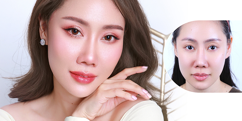 Eye Lift VS Cold Plasma Blepharoplasty: Surgical Techniques, Recovery, and Costs 1 Eye Lift VS Cold Plasma Blepharoplasty