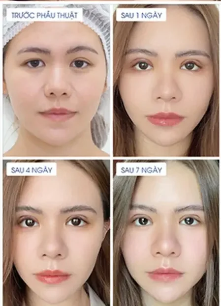eyes full big 449x1024 1 e1782877854649