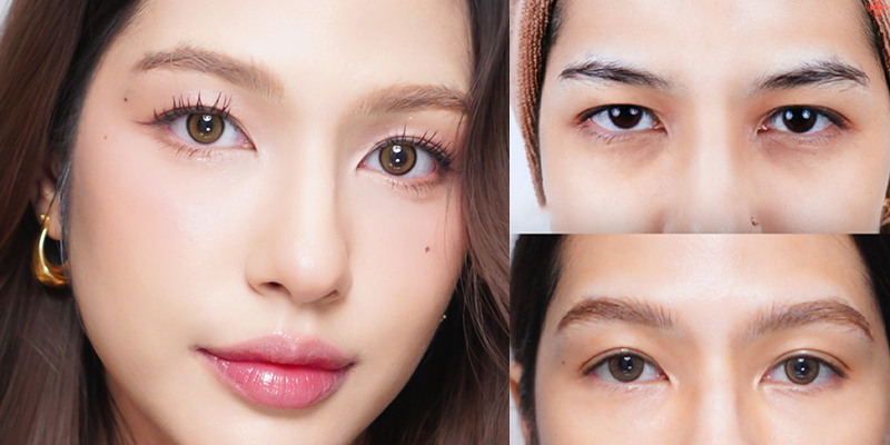How Much Does Eye Fat Grafting Cost in Ho Chi Minh City? 2026 Updated Prices 1 How Much Does Eye Fat Grafting Cost in Ho Chi Minh City?