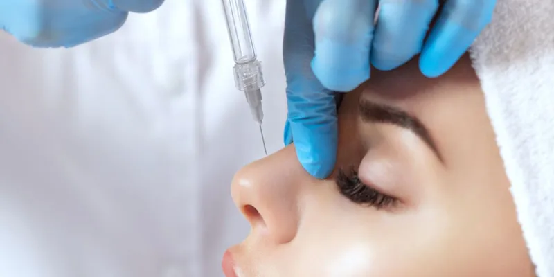 Nâng mũi không phẫu thuật tiêm filler hay dùng chỉ tốt hơn