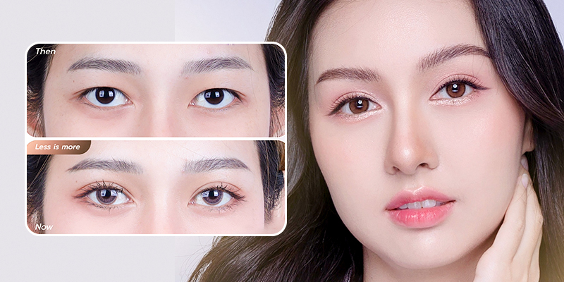 What Cosmetic Surgery Fits a Tet Trip to Vietnam? 2 What Cosmetic Surgery Fits a Tet Trip to Vietnam?
