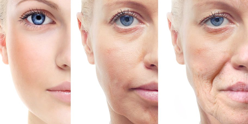 Smile Lines Treatment Cost 2026: Nasolabial Fold Removal Prices in Vietnam 2 Smile Lines Treatment Cost 2026