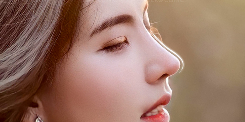 S-Line vs L-Line Rhinoplasty Comparison, Which Nose Shape Suits You? 2 S-Line rhinoplasty