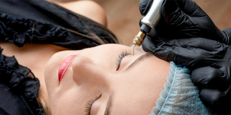 Non-Incisional Double Eyelid Surgery Cost: 2026 Price Guide for Suture and Plasma Methods in Vietnam 4 Non-Incisional Double Eyelid Surgery Cost