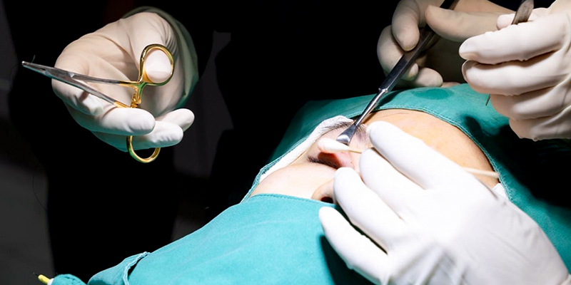 Droopy Eyelid: Causes, How to Fix It, and Surgery Cost in Vietnam 2026 4 one droopy eyelid