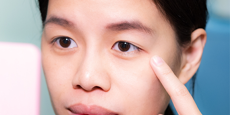 Droopy Eyelid: Causes, How to Fix It, and Surgery Cost in Vietnam 2026 1 one droopy eyelid cause