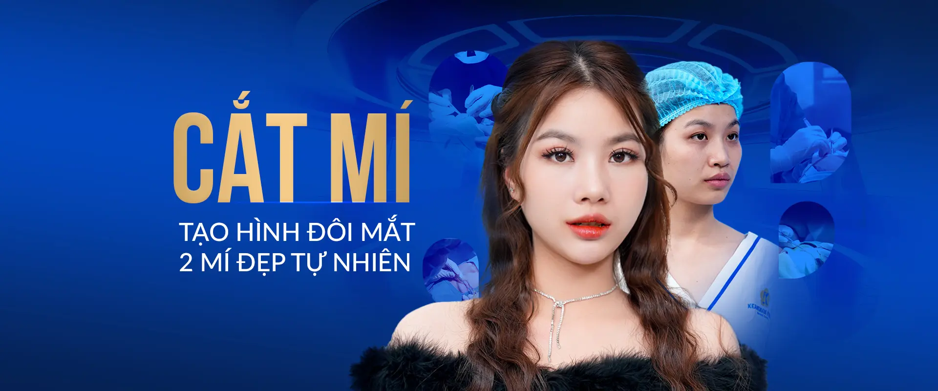 Cắt mí Perfect Eyes tạo hình đôi mắt đẹp tự nhiên