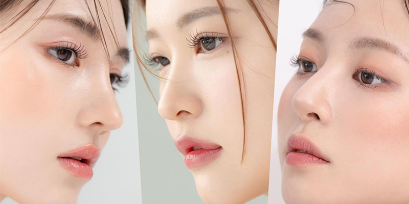 Rhinoplasty Cost in 2026: The Average Nose Job Price by Type in Vietnam 1 Rhinoplasty Cost in 2026