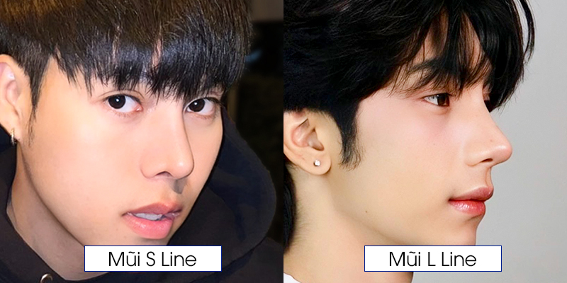 Male Rhinoplasty: How to Choose the Right Nose Shape for Your Face 3 Popular Male Nose Shapes