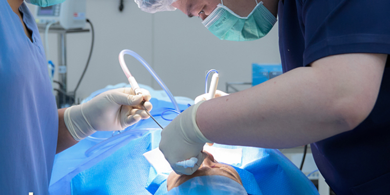 Rib Cartilage Rhinoplasty Cost in Vietnam 2026 3 Rib Cartilage Rhinoplasty Cost