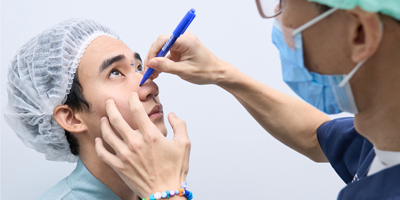 Rib Cartilage Rhinoplasty Cost in Vietnam 2026 4 Rib Cartilage Rhinoplasty Cost