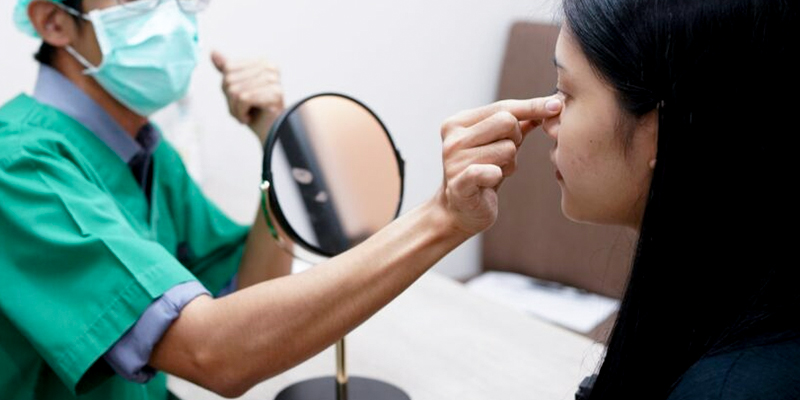 S-Line Rhinoplasty Cost 2026: The Complete Guide to Korean Nose Job Prices In Vietnam 5 S-Line Rhinoplasty Cost 2026