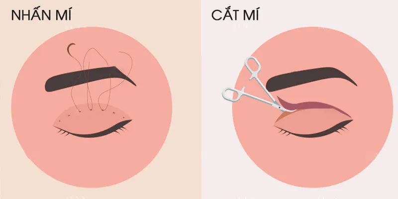 Cách khắc phục mí lót