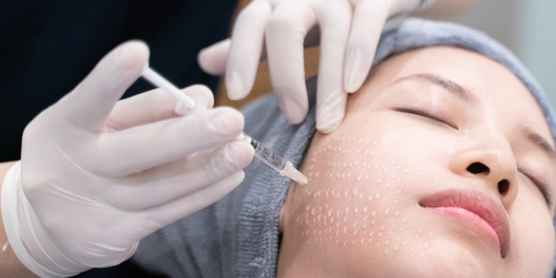 Mesotherapy Cost in 2026: Price Guide by Skin Treatment Goal 4 mesotherapy cost ho chi minh 3