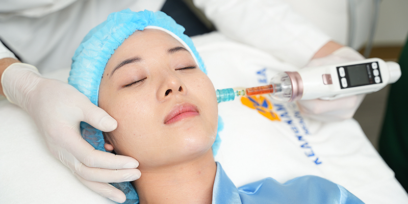 Mesotherapy Treatment: A Complete Guide to Healthy, Glowing Skin 5 The Mesotherapy Treatment Process