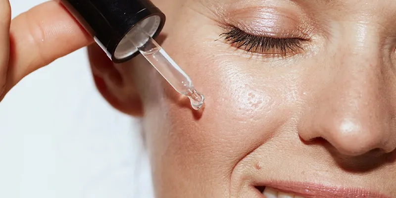 Cách trị sẹo rỗ mới hình thành nhanh chóng, tránh nguy hại về dài