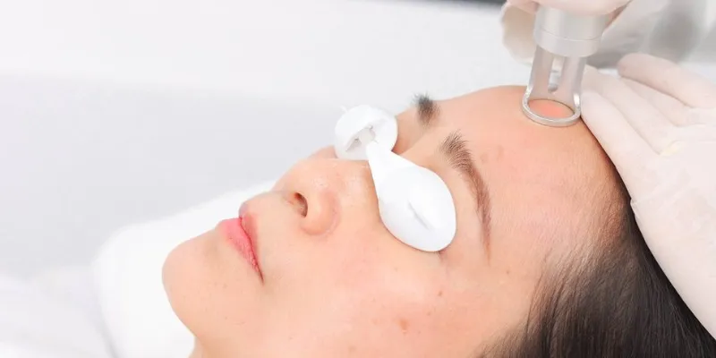 sẹo rỗ có trị được không