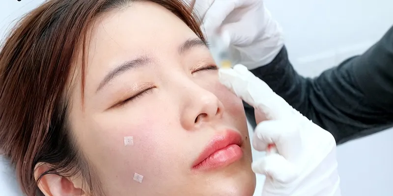 Tiêm căng bóng da có tốt không