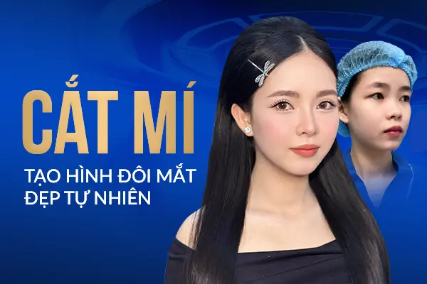Cắt mí Perfect Eyes tạo hình đôi mắt đẹp tự nhiên không tì vết