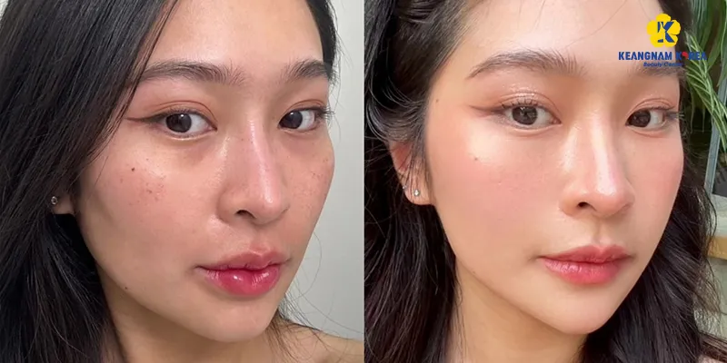 Cách làm da trắng cho người thường xuyên trang điểm