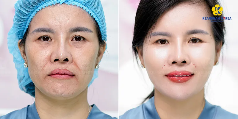 Các cách làm đẹp da mặt tại spa nên tiến hành định kỳ
