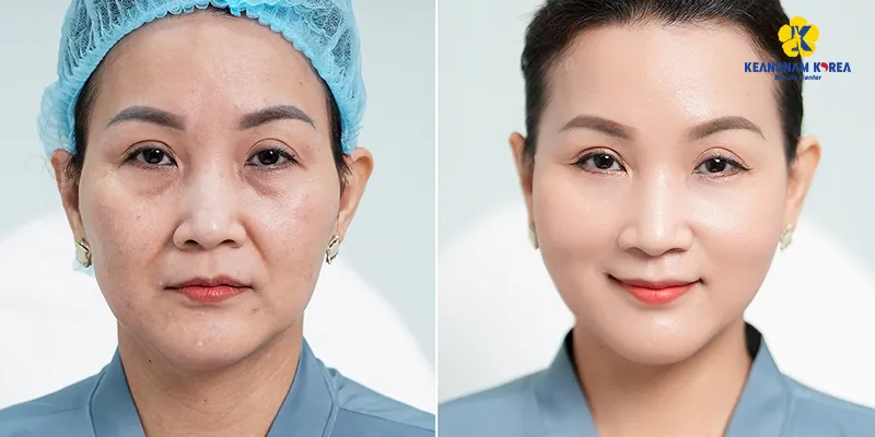 Các cách làm đẹp da mặt tại spa nên tiến hành định kỳ
