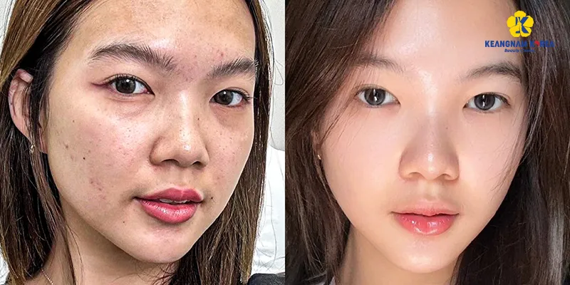 Các cách làm đẹp da mặt tại spa nên tiến hành định kỳ
