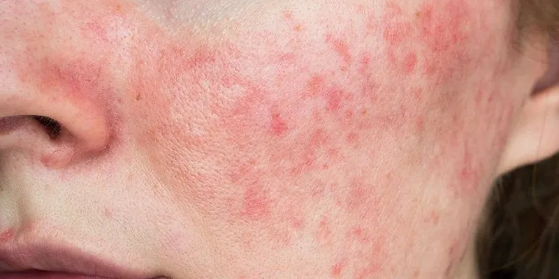 9 cách làm trắng da mặt hiệu quả
