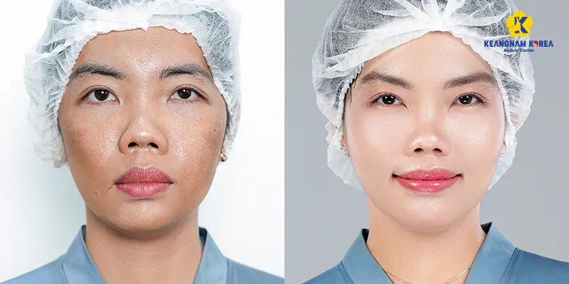 9 cách làm trắng da mặt hiệu quả