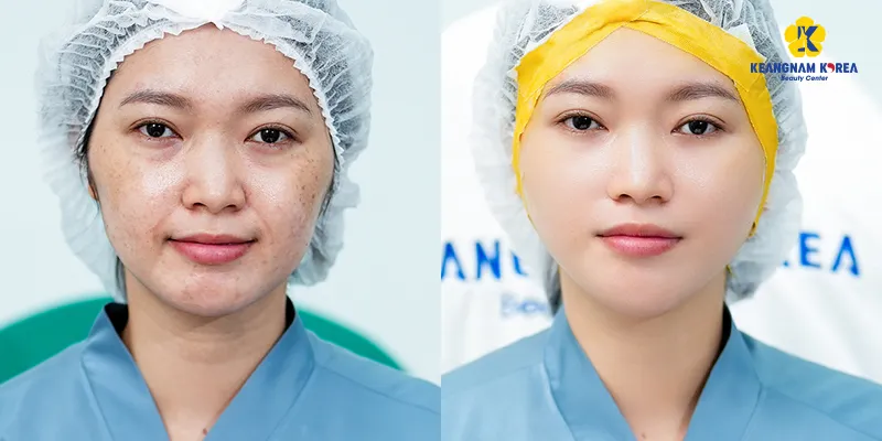 9 cách làm trắng da mặt hiệu quả