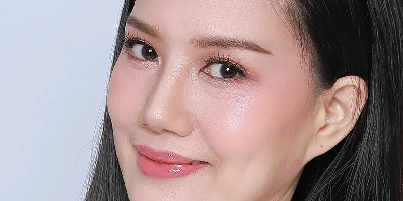 Cắt mí mắt dưới