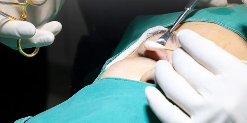 Cắt mí mắt có được vĩnh viễn không