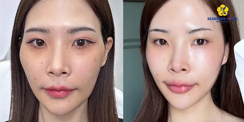 làm cách nào để trắng da