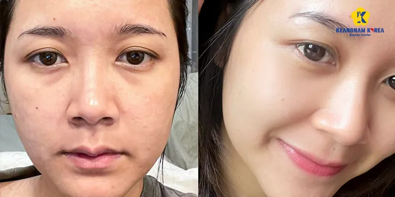 nen lam trang da mat tai nha hay spa 3