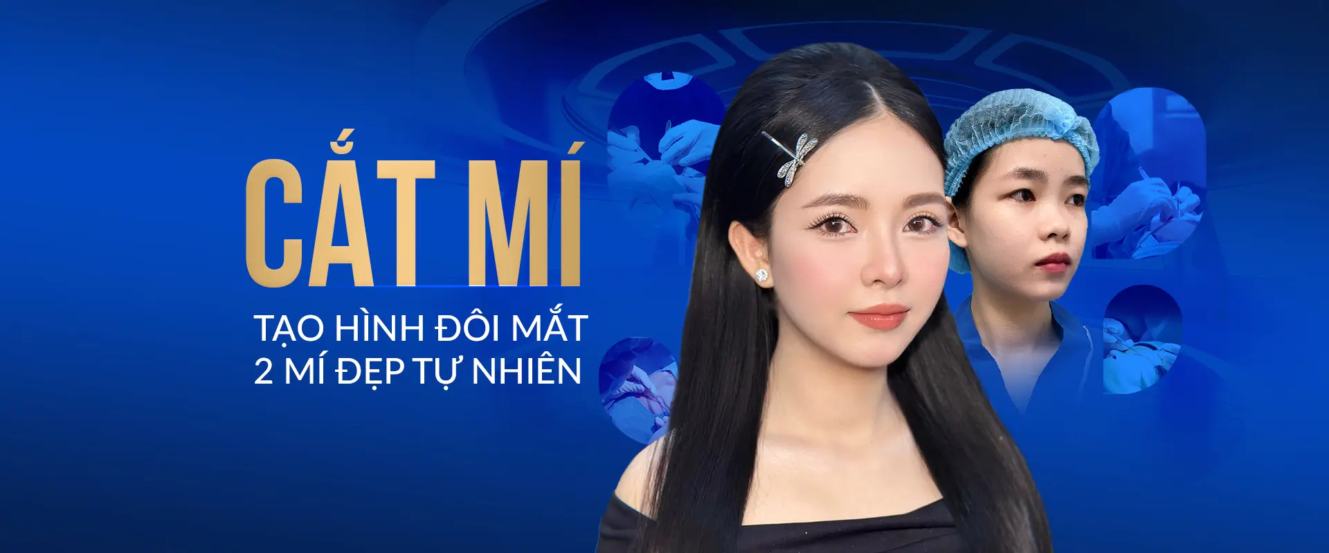 Cắt mí Perfect Eyes tạo hình đôi mắt đẹp tự nhiên