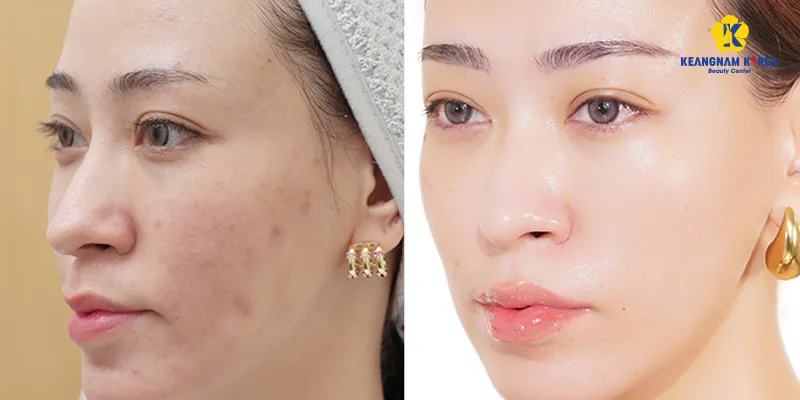 các cách phục hồi làn da bị lão hóa