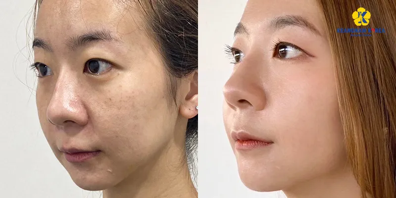 các cách phục hồi làn da bị lão hóa