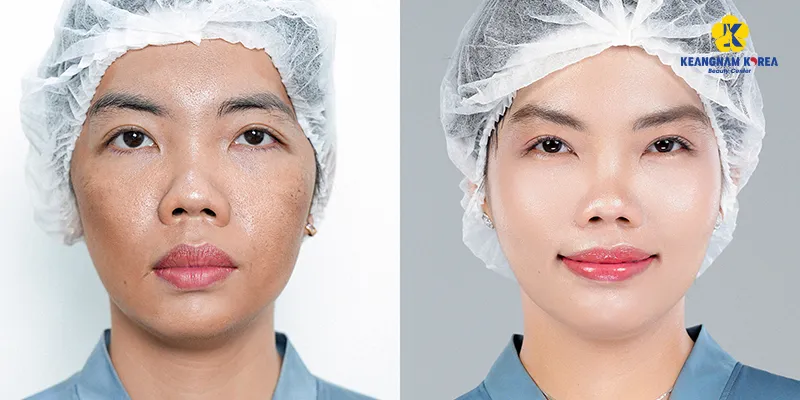 phục hồi làn da bị lão hóa