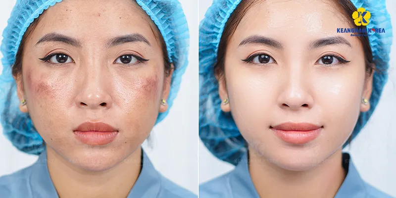 phục hồi làn da bị lão hóa