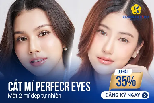 Cắt mí Perfect Eyes