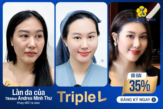 Căng bóng da nâng cơ trẻ hóa Triple L