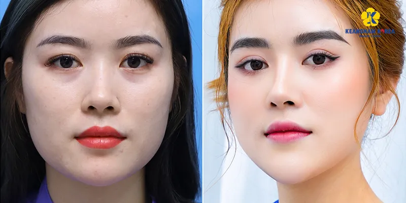 Các dáng mắt Hàn Quốc