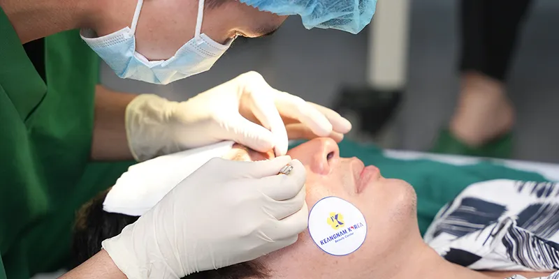 Cách chăm sóc sau khi lấy mỡ bọng mắt