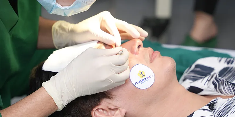 Cách xử lý và trị bọng mắt dưới
