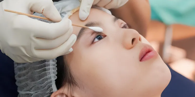 cắt mí kiêng hải sản bao lâu