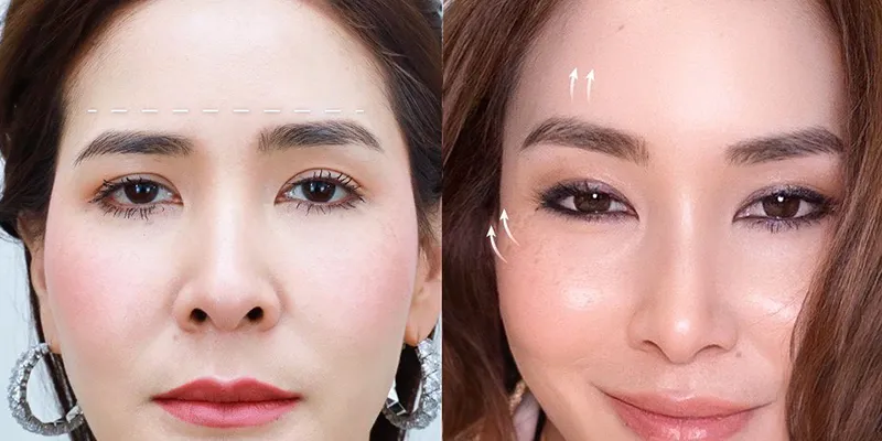 treo cung mày