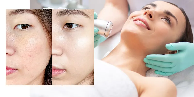 4 Cách làm đẹp da mặt từ thiên nhiên 